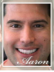 Smile Makeover - Aaron