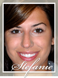 Smile Makeover - Stephanie